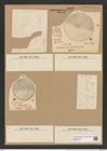 Coscinodiscus capensis Grun. (de-Toni-Nr.: Genus 202, Species 4923) Zeichnungen Sammlung Grunow Nr. 8692 (NHMW-BOT-W0378113)